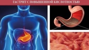 Блюда и продукты для снижения кислотности желудка Блюда и продукты для снижения кислотности желудка