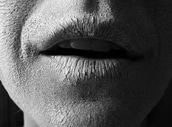 Плохой запах изо рта Плохой запах изо рта