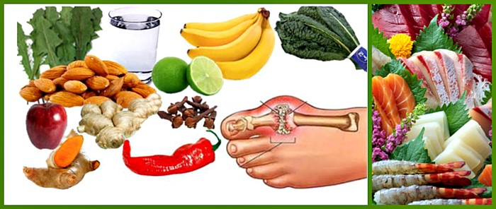 Подагрический артрит: симптомы и лечение острой формы при подагре Подагрический артрит: симптомы и лечение острой формы при подагре