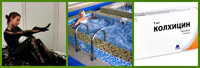 Подагрический артрит: симптомы и лечение острой формы при подагре Подагрический артрит: симптомы и лечение острой формы при подагре