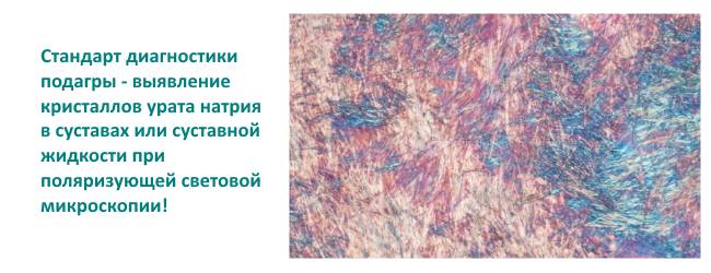 Анализы для диагностики при подагре Анализы для диагностики при подагре