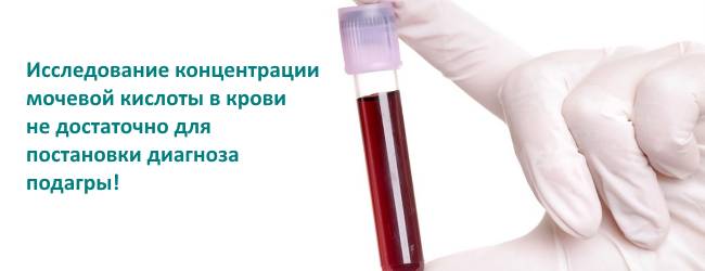 Анализы для диагностики при подагре Анализы для диагностики при подагре