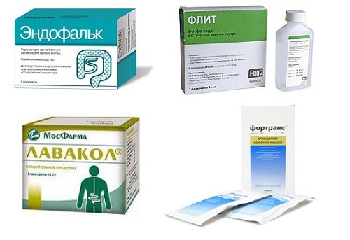 Диагностическая процедура колоноскопии кишечника Диагностическая процедура колоноскопии кишечника