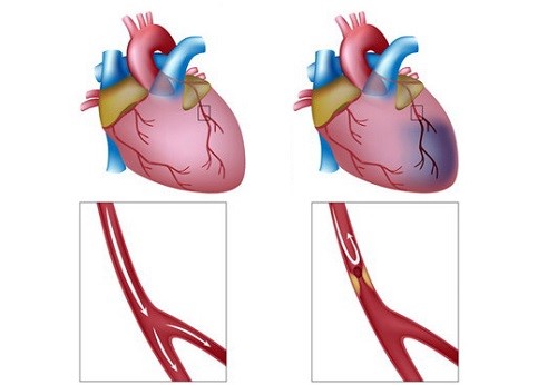 Диагностическая процедура колоноскопии кишечника Диагностическая процедура колоноскопии кишечника