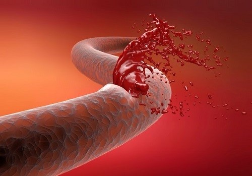 Диагностическая процедура колоноскопии кишечника Диагностическая процедура колоноскопии кишечника