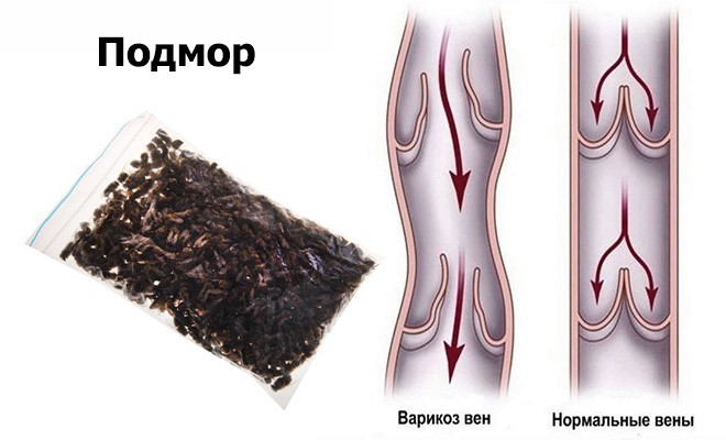 Лечение варикоза пчелами (апитерапия) Лечение варикоза пчелами (апитерапия)