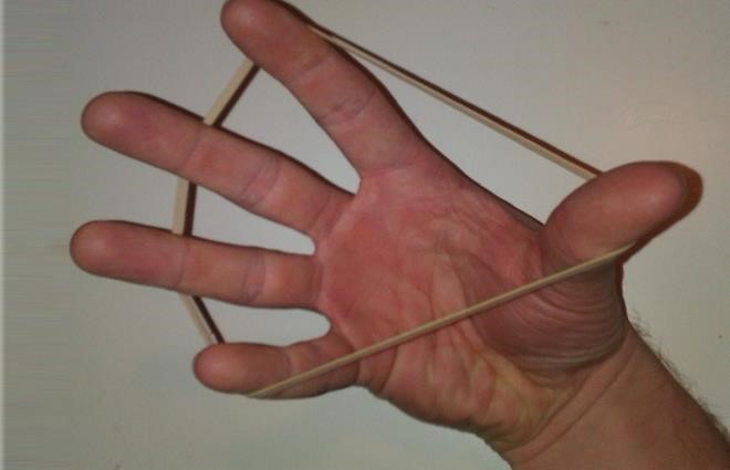 Полиартрит рук Полиартрит рук