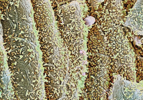 Препараты от дисбактериоза при приеме антибиотиков: пребиотики, пробиотики, лактобактерии... Препараты от дисбактериоза при приеме антибиотиков: пребиотики, пробиотики, лактобактерии...