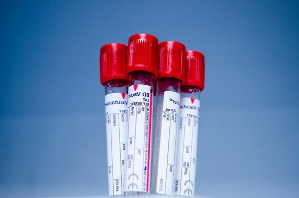 Печеночные трансаминазы - что это? Причины повышения уровня ферментов Печеночные трансаминазы - что это? Причины повышения уровня ферментов