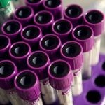 Печеночные трансаминазы - что это? Причины повышения уровня ферментов Печеночные трансаминазы - что это? Причины повышения уровня ферментов