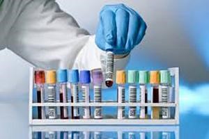 Анализ крови на АСТ и что значит, если этот показатель повышен Анализ крови на АСТ и что значит, если этот показатель повышен