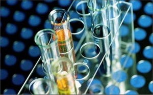 Анализ крови на АСТ и что значит, если этот показатель повышен Анализ крови на АСТ и что значит, если этот показатель повышен