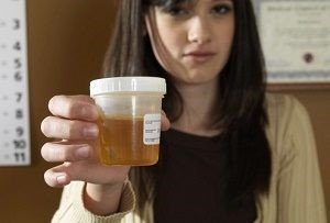 Белок в моче у мужчин — что это значит, какова его норма? Белок в моче у мужчин — что это значит, какова его норма?