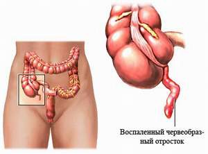 Болит справа под ребрами сзади со спины Болит справа под ребрами сзади со спины