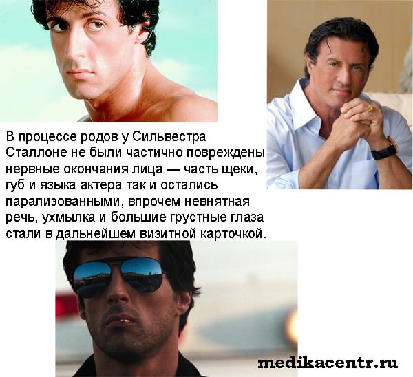 Причины и симптомы пневмонии у детей Причины и симптомы пневмонии у детей