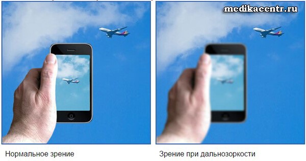 Причины и симптомы пневмонии у детей Причины и симптомы пневмонии у детей