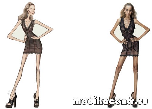 Причины и симптомы пневмонии у детей Причины и симптомы пневмонии у детей