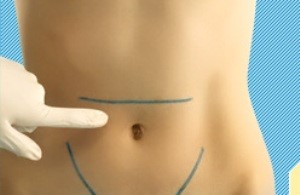 Грыжа пупка у взрослых и у ребенка Грыжа пупка у взрослых и у ребенка