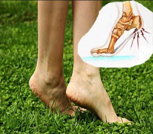 Мазь для лечения пяточной шпоры: чем мазать пятки Мазь для лечения пяточной шпоры: чем мазать пятки