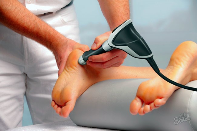 Пяточная шпора лечение в домашних Пяточная шпора лечение в домашних