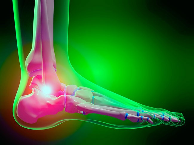 Пяточная шпора лечение в домашних Пяточная шпора лечение в домашних