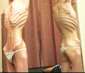 Антральный отдел желудка Антральный отдел желудка