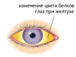 Прогноз при раке поджелудочной в зависимости от стадии Прогноз при раке поджелудочной в зависимости от стадии