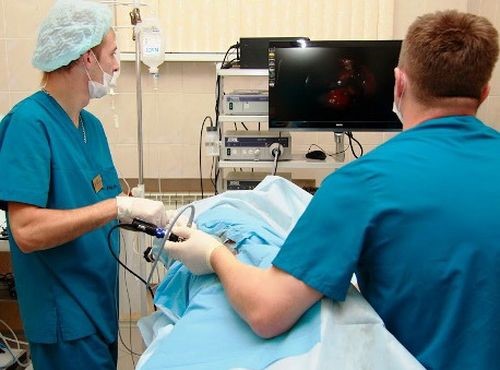 Стадии и симптомы рака сигмовидной кишки Стадии и симптомы рака сигмовидной кишки