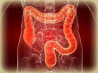 Какие симптомы при опухоли слепой кишки? Какие симптомы при опухоли слепой кишки?