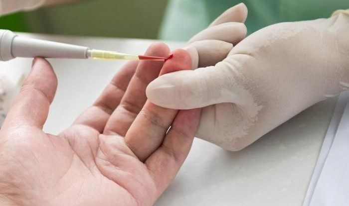 Анизоцитоз эритроцитов в анализе крови (индекс RDW) Анизоцитоз эритроцитов в анализе крови (индекс RDW)