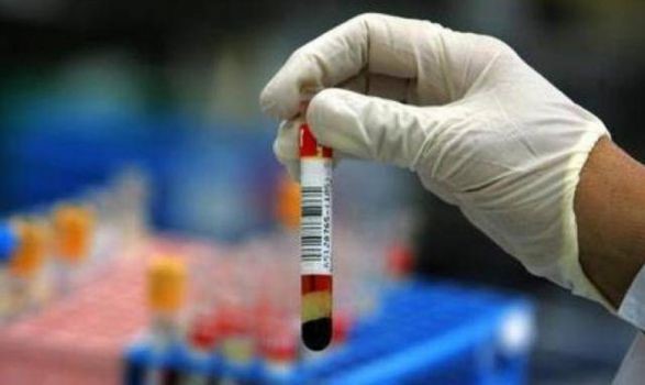 Анизоцитоз эритроцитов в анализе крови (индекс RDW) Анизоцитоз эритроцитов в анализе крови (индекс RDW)