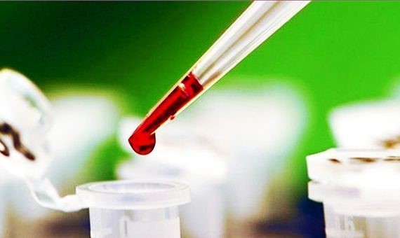 Анизоцитоз эритроцитов в анализе крови (индекс RDW) Анизоцитоз эритроцитов в анализе крови (индекс RDW)