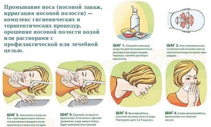 Какие растворы можно использовать, чтобы промыть нос дома? Какие растворы можно использовать, чтобы промыть нос дома?