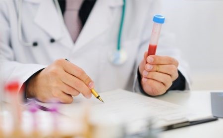 Анализ крови на реакцию Вассермана (RW) Анализ крови на реакцию Вассермана (RW)