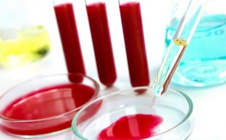 Анализ крови на реакцию Вассермана (RW) Анализ крови на реакцию Вассермана (RW)