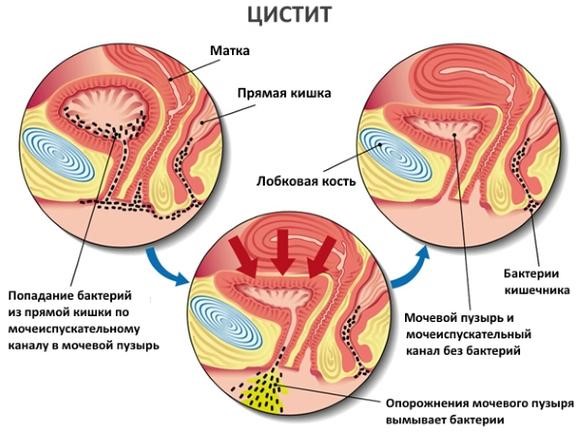 Сильные рези внизу живота: повод вызывать скорую? Сильные рези внизу живота: повод вызывать скорую?