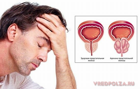 Сабельник: полезные свойства и противопоказания к применению для суставов Сабельник: полезные свойства и противопоказания к применению для суставов