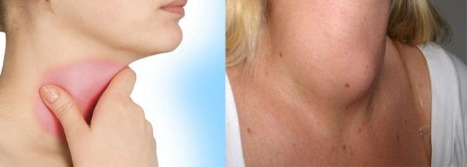 Анатомия гортани, функциональность хрящей Анатомия гортани, функциональность хрящей