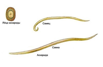 Определение заражения - как выглядят человеческие глисты? Определение заражения - как выглядят человеческие глисты?