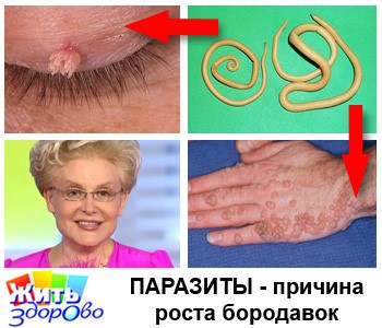 Болезнь (синдром) Рейно: симптомы, лечение, причины Болезнь (синдром) Рейно: симптомы, лечение, причины