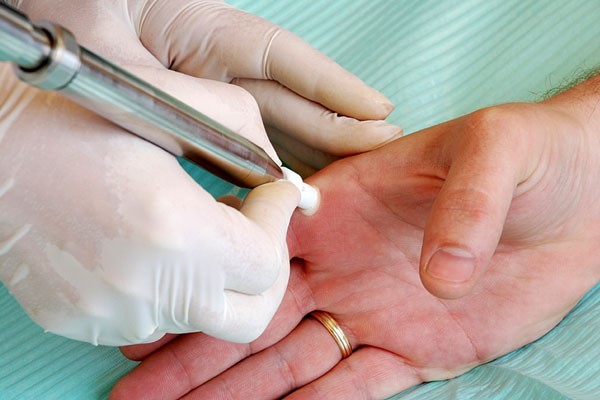 Склеродермия: системная, очаговая - лечение, симптомы Склеродермия: системная, очаговая - лечение, симптомы