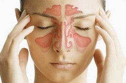 Особенности сложных капель для носа Особенности сложных капель для носа