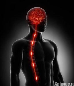 Инсульт спинного мозга Инсульт спинного мозга