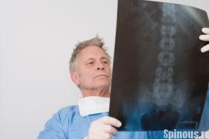 Инсульт спинного мозга Инсульт спинного мозга