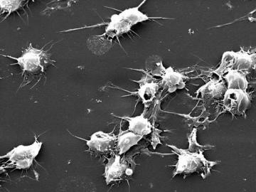 Причины снижения количества и среднего объема тромбоцитов в крови Причины снижения количества и среднего объема тромбоцитов в крови