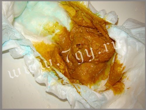 Устранение жидкого стула у грудничка на грудном вскармливании: терапия для новорожденного Устранение жидкого стула у грудничка на грудном вскармливании: терапия для новорожденного