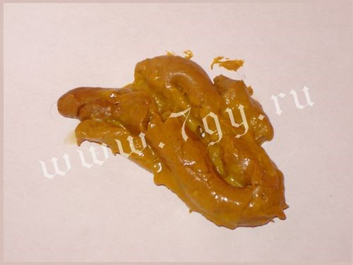 Устранение жидкого стула у грудничка на грудном вскармливании: терапия для новорожденного Устранение жидкого стула у грудничка на грудном вскармливании: терапия для новорожденного