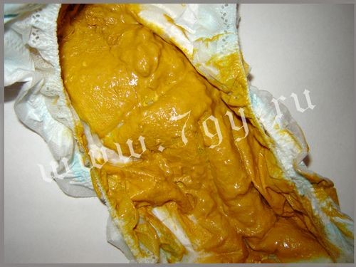 Устранение жидкого стула у грудничка на грудном вскармливании: терапия для новорожденного Устранение жидкого стула у грудничка на грудном вскармливании: терапия для новорожденного