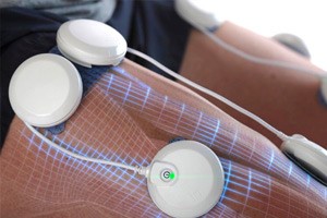 Тендинит сухожилия надостной мышцы Тендинит сухожилия надостной мышцы