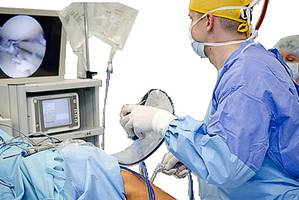 Тендинит сухожилия надостной мышцы Тендинит сухожилия надостной мышцы